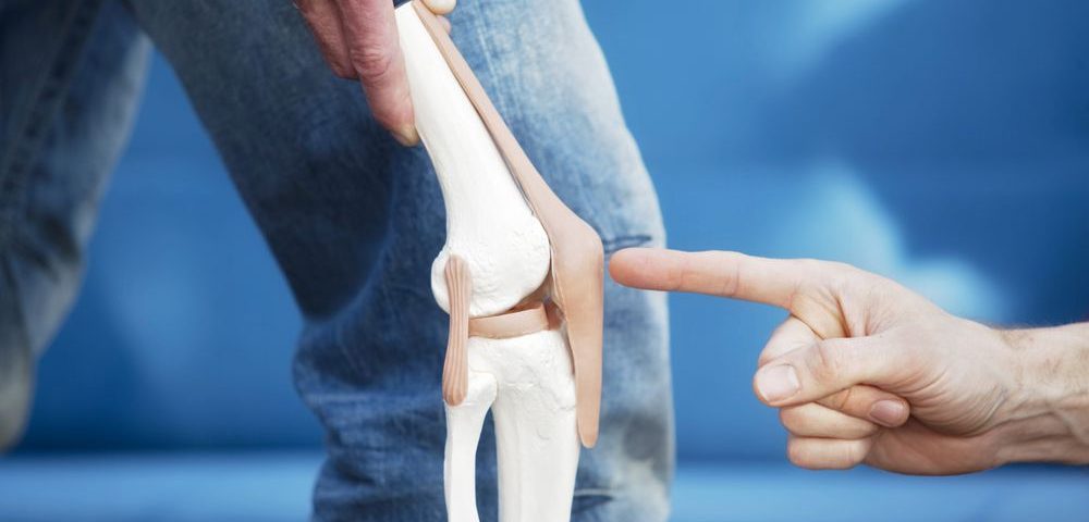 دررفتگی کشکک زانو : علت، علائم و درمان بازار سلامت