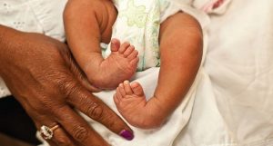 پا چنبری (کلاب فوت) : شایع ترین ناهنجاری مادرزادی پا در کودکان