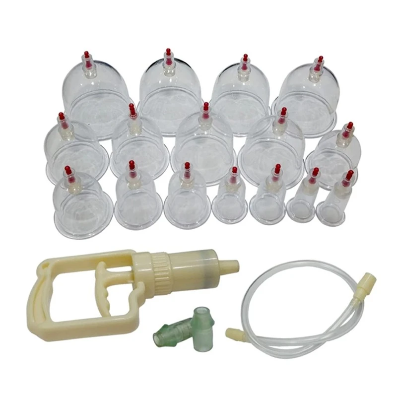 cupping (1).jpg