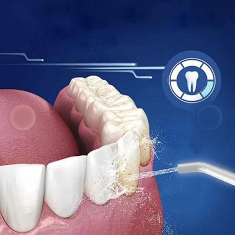 واترجت KMD (4).webp