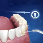 واترجت KMD (4).webp