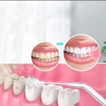 واترجت KMD مدل X7 (4).webp