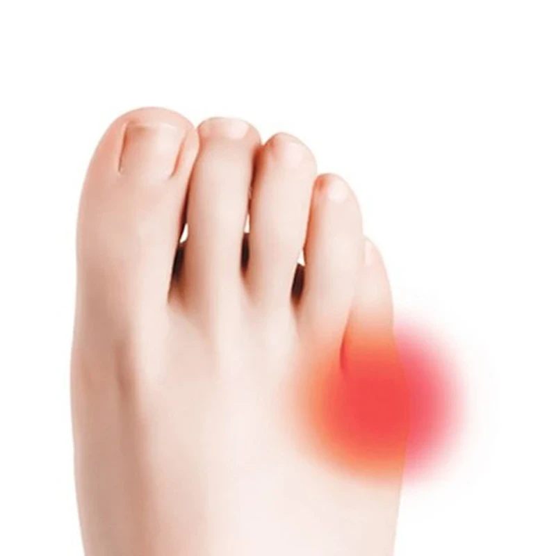 پد انحراف انگشت کوچک (4).webp